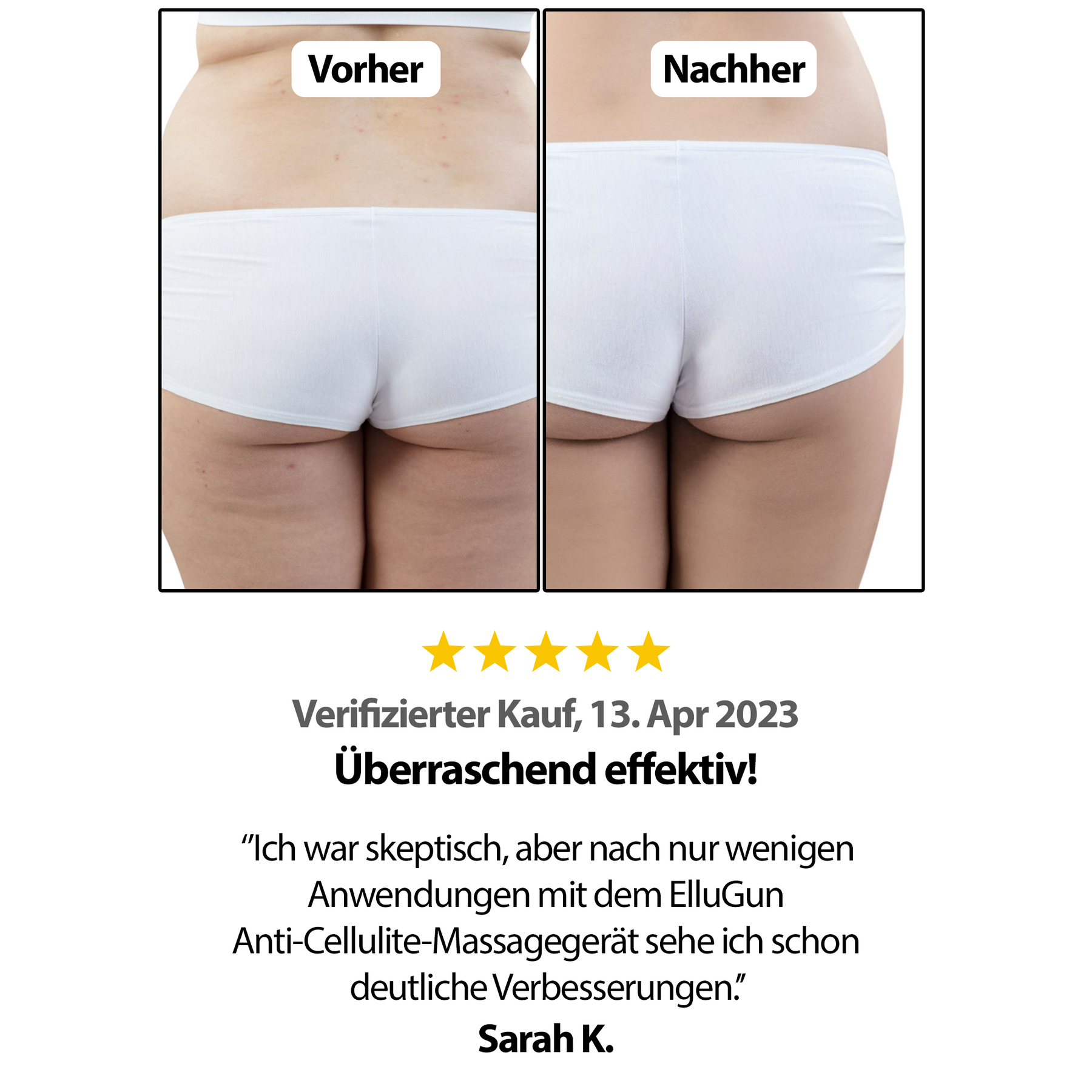 Anti Cellulite Massagegerät