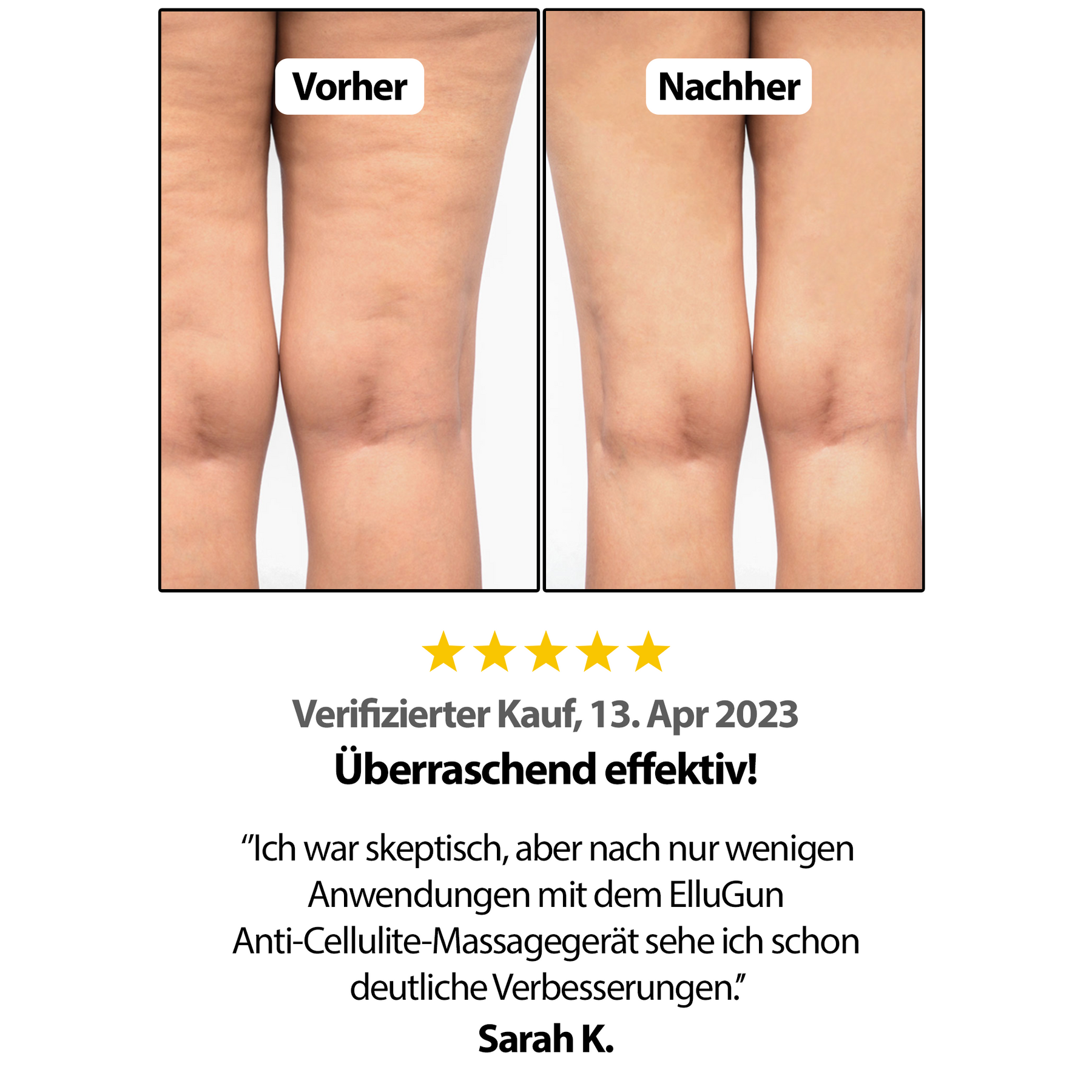 Anti Cellulite Massagegerät