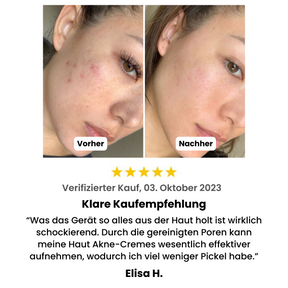 HY-DRO  Porenreiniger