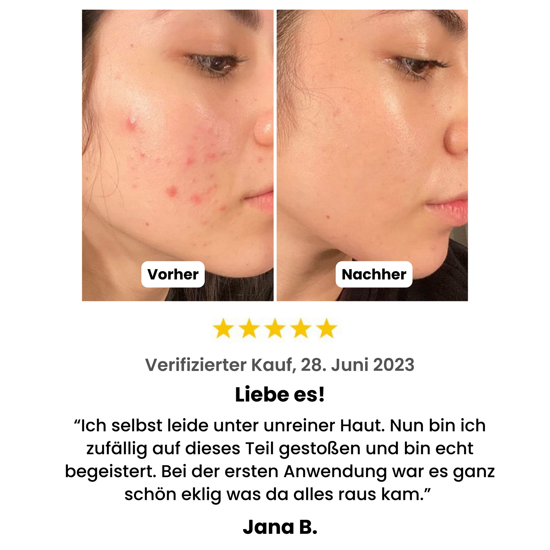 Ultrasonic Facescrub