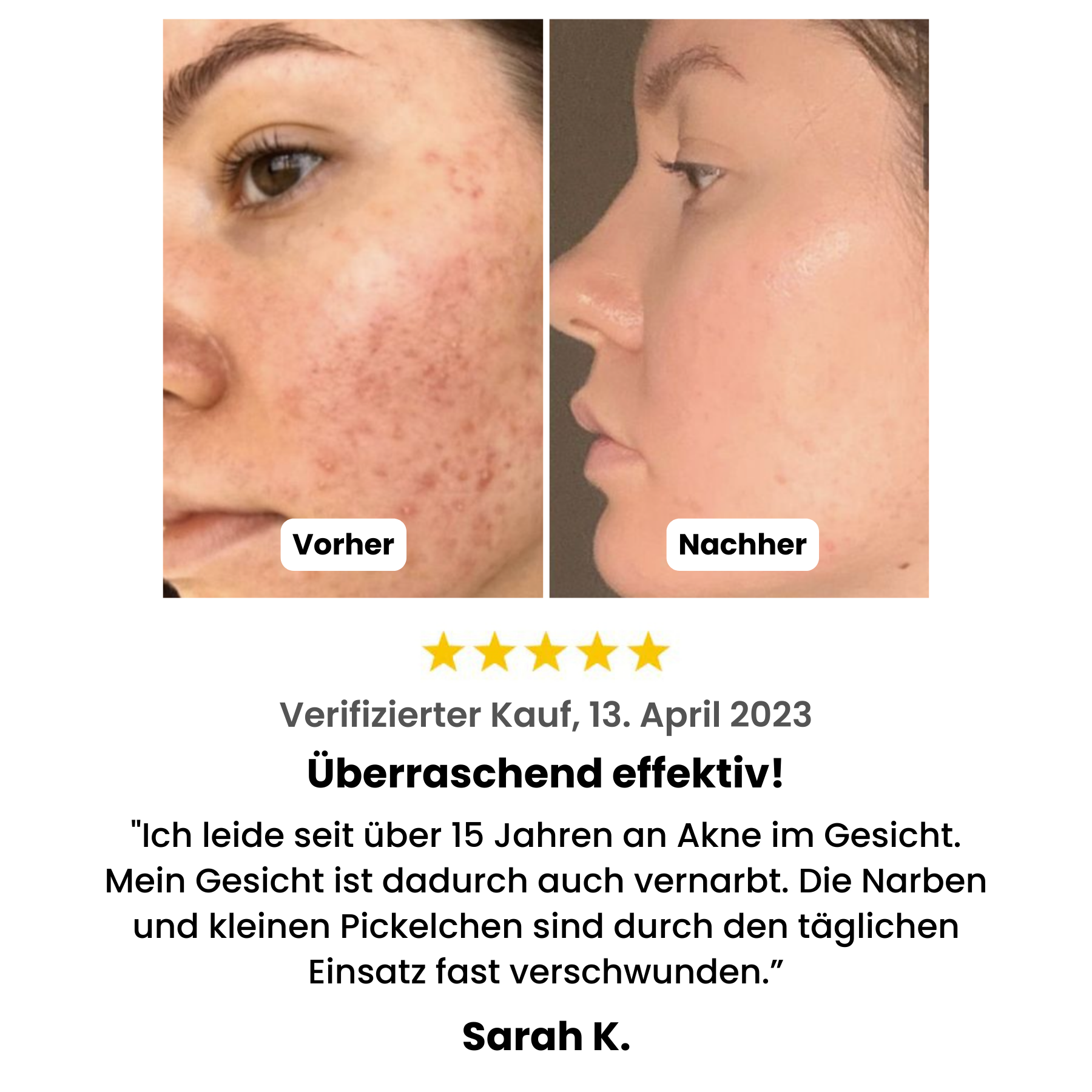 HY-DRO  Porenreiniger