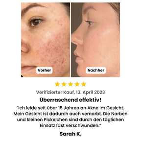 HY-DRO  Porenreiniger