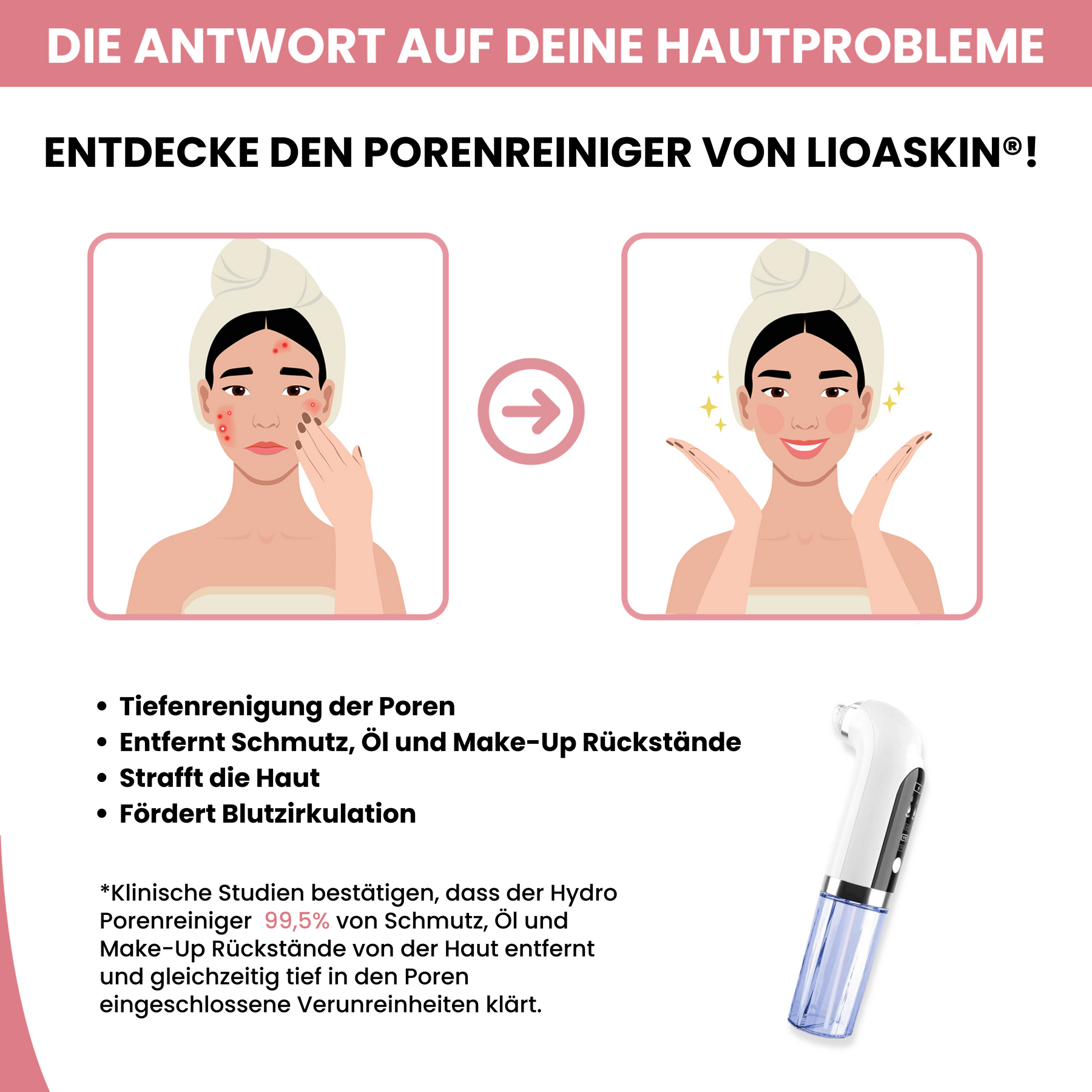 HY-DRO  Porenreiniger